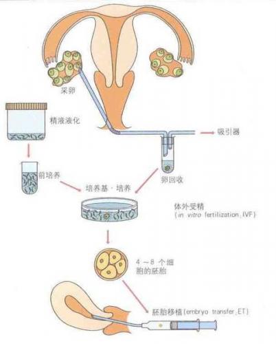 供卵试管婴儿如何预防胎儿流产？--恩施福瑞德天使