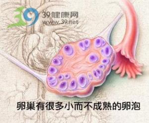人工授精和借卵做试管婴儿的区别是什么，如何做出选择？