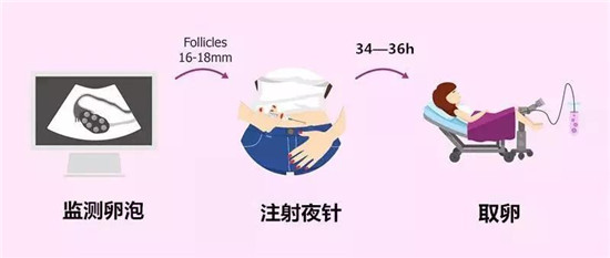 如何计算供卵做试管婴儿的生育期