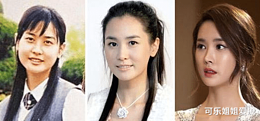 借卵赠卵试管代怀过程疼吗-女人做借卵二代供卵试管疼吗