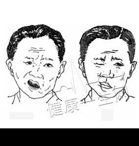 什么是遗传性不孕症？我可以做供卵借卵试管代生吗？