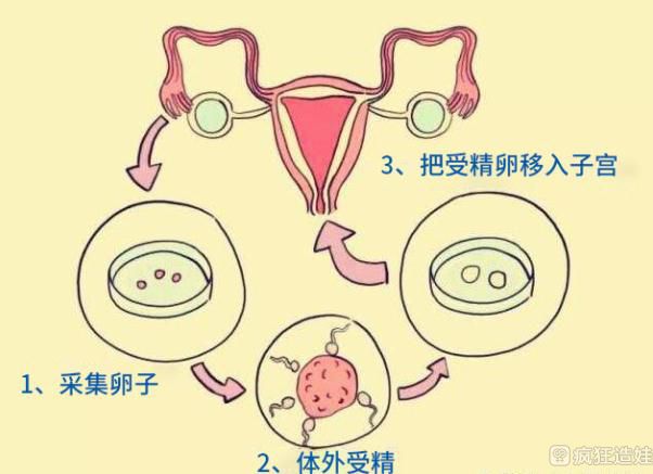 试管婴儿囊胚级别