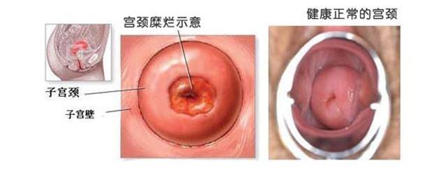 武汉市试管代怀是不是骗人多少钱(大致21435元)