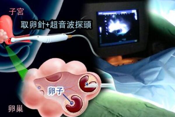 湖北武汉试管价格由那些因素决定